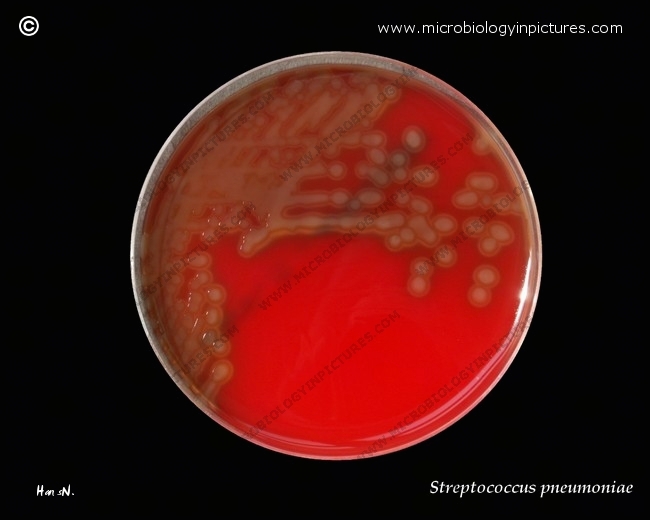 streptococcus pneumoniae